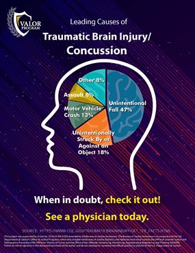 Image for Leading Causes of Concussions