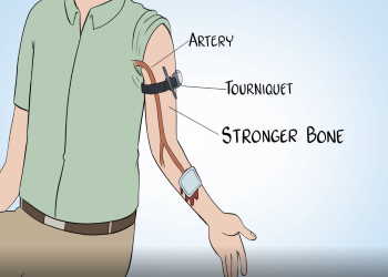 Stress Inoculation